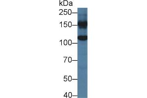 Western blot analysis of Mouse Liver lysate, using Human GLDC Antibody (2 µg/ml) and HRP-conjugated Goat Anti-Rabbit antibody ( (GLDC Antikörper  (AA 81-268))