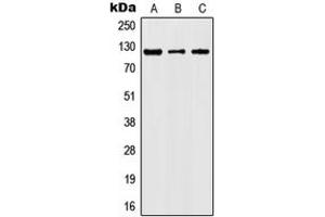 Western blot analysis of JAK2 (pY1007) expression in HeLa (A), TF1 (B), NIH3T3 (C), rat kidney (D) whole cell lysates. (JAK2 Antikörper  (C-Term, pTyr1007))