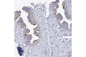 Immunohistochemical staining of human fallopian tube with DNAH6 polyclonal antibody  shows strong membranous positivity in glandular cells. (DNAH6 Antikörper)
