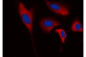 Immunofluorescent analysis of INPP5J staining in HEK293T cells. (INPP5J Antikörper  (C-Term))