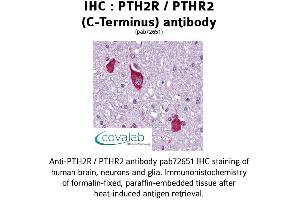 Image no. 1 for anti-Parathyroid Hormone 2 Receptor (PTH2R) (C-Term), (pThr2) antibody (ABIN1738583) (PTH2R Antikörper  (C-Term, pThr2))