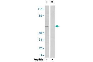Western blot analysis of extracts from HeLa cells, using ADRB2 polyclonal antibody . (beta 2 Adrenergic Receptor Antikörper  (C-Term))