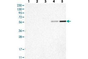 Western blot analysis of Lane 1: RT-4, Lane 2: U-251 MG, Lane 3: Human Plasma, Lane 4: Liver, Lane 5: Tonsil with RMND1 polyclonal antibody . (RMND1 Antikörper)