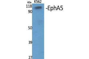 Western Blot (WB) analysis of specific cells using EphA5 Polyclonal Antibody.