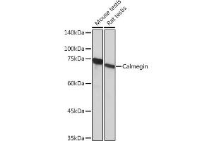 Western blot analysis of extracts of various cell lines, using Calmegin Rabbit mAb (ABIN7266026) at 1:1000 dilution. (Calmegin Antikörper)