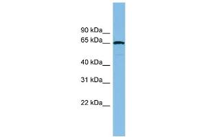 WB Suggested Anti-RAD18 Antibody Titration: 0. (RAD18 Antikörper  (Middle Region))