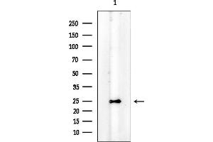 Western blot analysis of lysates from Mouse testis, using NT5C Mouse Monoclonal Antibody at 1/1000 dilution.