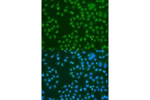 Immunofluorescence analysis of U2OS cells using KAT5 antibody.