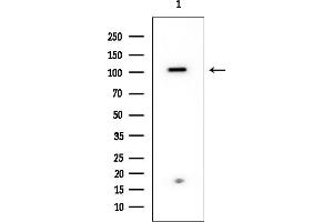 anti-Epidermal Growth Factor Receptor Pathway Substrate 15 (EPS15) antibody