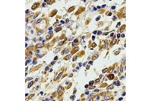 Immunohistochemical analysis of Glutaredoxin staining in human stomach formalin fixed paraffin embedded tissue section.