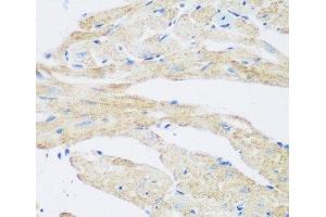 Immunohistochemistry of paraffin-embedded Mouse heart using NAT8B Polyclonal Antibody at dilution of 1:200 (40x lens).