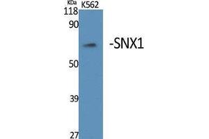 Western Blotting (WB) image for anti-Sorting Nexin 1 (SNX1) (Internal Region) antibody (ABIN3177459) (Sorting Nexin 1 Antikörper  (Internal Region))