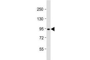 Western blot testing of Dnmt3b antibody at 1:2000 dilution + T47D lysate; Predicted molecular weight: 95 kDa. (DNMT3B Antikörper  (AA 389-417))