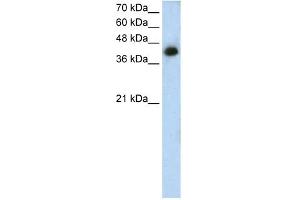 WB Suggested Anti-MTUS1 Antibody Titration: 1. (MTUS1 Antikörper  (N-Term))
