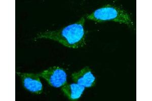 IF analysis of Alpha A Crystallin using anti-Alpha A Crystallin antibody (ABIN7599030).
