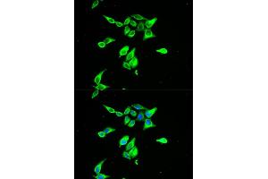 Immunofluorescence analysis of A549 cells using CD55 antibody (ABIN5970570). (CD55 Antikörper)
