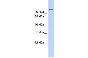 WB Suggested Anti-RBBP8 Antibody Titration:  0. (Retinoblastoma Binding Protein 8 Antikörper  (C-Term))