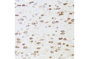 Immunohistochemistry of paraffin-embedded rat brain using ARHGAP5 antibody.