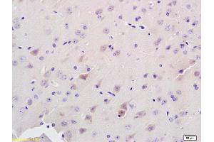Immunohistochemistry (IHC) image for anti-ADAM Metallopeptidase with Thrombospondin Type 1 Motif, 7 (ADAMTS7) (AA 241-340) antibody (ABIN672486)