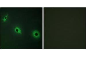 Immunofluorescence analysis of HepG2 cells, using CELSR3 Antibody. (CELSR3 Antikörper  (AA 91-140))