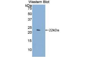 Western Blotting (WB) image for anti-C-Type Lectin Domain Family 4, Member M (CLEC4M) (AA 242-399) antibody (ABIN1858422) (C-Type Lectin Domain Family 4, Member M (CLEC4M) (AA 242-399) Antikörper)