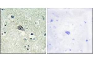 Immunohistochemistry analysis of paraffin-embedded human brain, using NMDAR1 (Phospho-Ser890) Antibody.