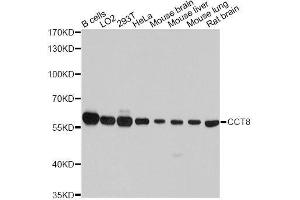 Western blot analysis of extracts of various cell lines, using CCT8 antibody. (CCT8 Antikörper  (AA 248-497))