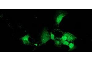 Image no. 1 for anti-DnaJ (Hsp40) Homolog, Subfamily B, Member 2 (DNAJB2) antibody (ABIN1497868) (DNAJB2 Antikörper)