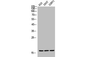 Western Blot analysis of 823 293T 22RV cells using CD235a Polyclonal Antibody (CD235a/GYPA Antikörper  (Internal Region))