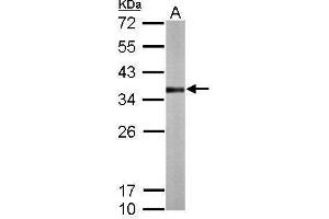 Western Blotting (WB) image for anti-Thiosulfate Sulfurtransferase (Rhodanese) (TST) antibody (ABIN2856290)