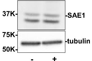 Western blot using  Rabbit anti-SAE1 antibody shows detection of SAE1. (SAE1 Antikörper  (Internal Region))