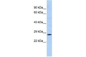 RAB38 antibody used at 1 ug/ml to detect target protein. (RAB38 Antikörper  (N-Term))