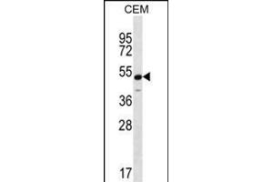 KCNJ8 Antibody (N-term) (ABIN656236 and ABIN2845552) western blot analysis in CEM cell line lysates (35 μg/lane).
