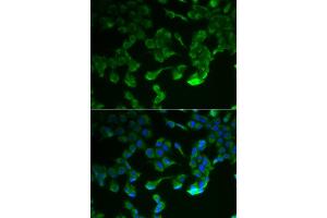 Immunofluorescence analysis of HeLa cell using C1R antibody. (C1R Antikörper)
