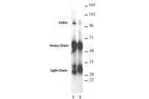 CHD3 antibody (rAb) tested antibody tested by immunoprecipitation.