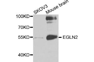 Western blot analysis of extracts of various cell lines, using EGLN2 antibody (ABIN5971259) at 1/1000 dilution. (PHD1 Antikörper)