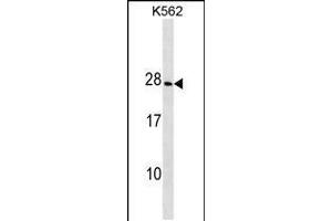 Western blot analysis in K562 cell line lysates (35ug/lane). (CRYGD Antikörper  (AA 73-101))