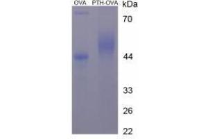 Image no. 1 for Parathyroid Hormone (PTH) peptide (Ovalbumin) (ABIN5666325) (Parathyroid Hormone (PTH) peptide (Ovalbumin))