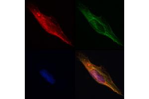 ABIN6261605 and ABIN6268755 staining Hela by IF/ICC. (EpCAM Antikörper  (Internal Region))