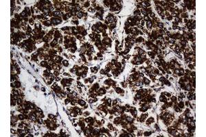 Image no. 3 for anti-NADH Dehydrogenase (Ubiquinone) 1 beta Subcomplex, 10, 22kDa (NDUFB10) antibody (ABIN1499672) (NDUFB10 Antikörper)