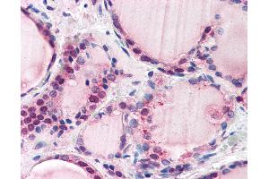 Anti-FBXL3 antibody IHC of human thyroid. (FBXL3 Antikörper  (AA 2-15))