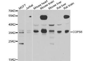 Western blot analysis of extracts of various cell lines, using COPS6 antibody. (COPS6 Antikörper)