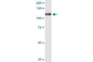 Immunoprecipitation of ITIH1 transfected lysate using anti-ITIH1 MaxPab rabbit polyclonal antibody and Protein A Magnetic Bead , and immunoblotted with ITIH1 purified MaxPab mouse polyclonal antibody (B01P) . (ITIH1 Antikörper  (AA 1-911))