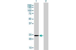 Western Blotting (WB) image for anti-Adenylate Kinase 1 (AK1) (AA 1-194) antibody (ABIN559821)