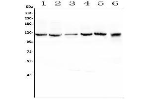 Western blot analysis of SLC12A5 using anti-SLC12A5 antibody (ABIN6719415).
