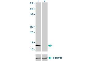 Western blot analysis of FABP3 over-expressed 293 cell line, cotransfected with FABP3 Validated Chimera RNAi (Lane 2) or non-transfected control (Lane 1). (FABP3 Antikörper  (AA 1-133))