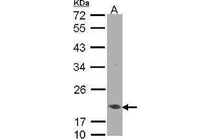 Western Blotting (WB) image for anti-Eukaryotic Translation Elongation Factor 1 epsilon 1 (EEF1E1) antibody (ABIN2856150)