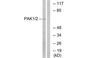 Western blot analysis of extracts from K562 cells, using PAK1/2 (Ab-199) antibody. (PAK1 Antikörper  (Ser199))