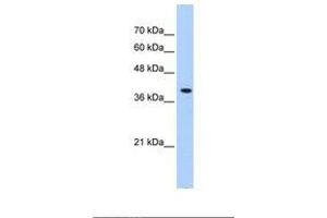 Image no. 2 for anti-Peroxisomal Biogenesis Factor 10 (PEX10) (AA 201-250) antibody (ABIN6738077) (PEX10 Antikörper  (AA 201-250))