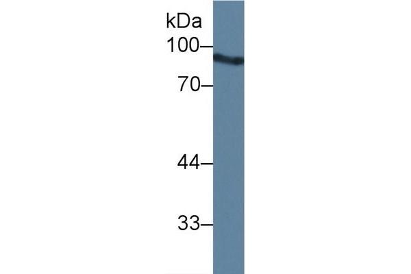 Angiostatin Antikörper  (AA 79-466)